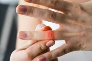 man experiencing finger pain