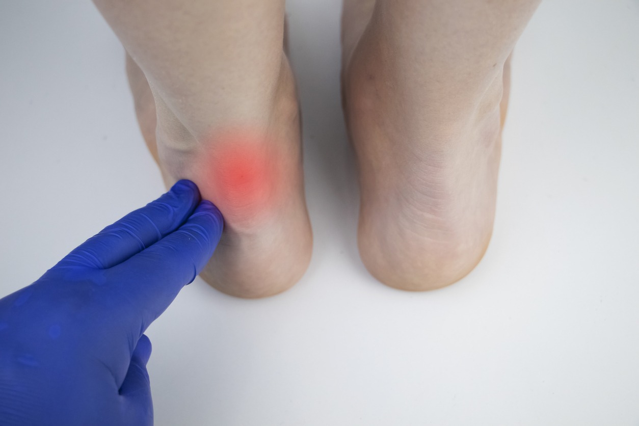 pain in the Achilles tendon